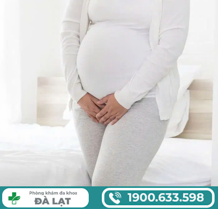 Hình ảnh minh họa